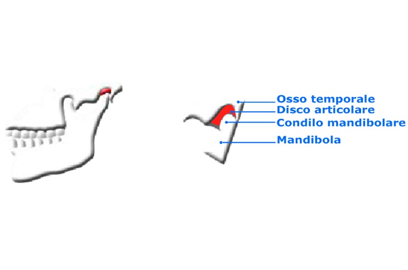 L'Articolazione Temporo Mandibolare