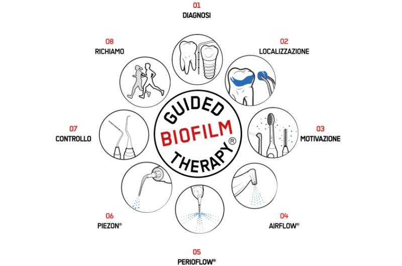 GLI 8 STEP DEL PROTOCOLLO GBT